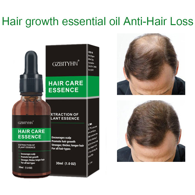 Hair Growth Oil Hair Growth Oil Oem Hair Care Essential Oil